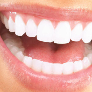 Dişeti Hastalıkları Tedavisi (Periodontoloji)